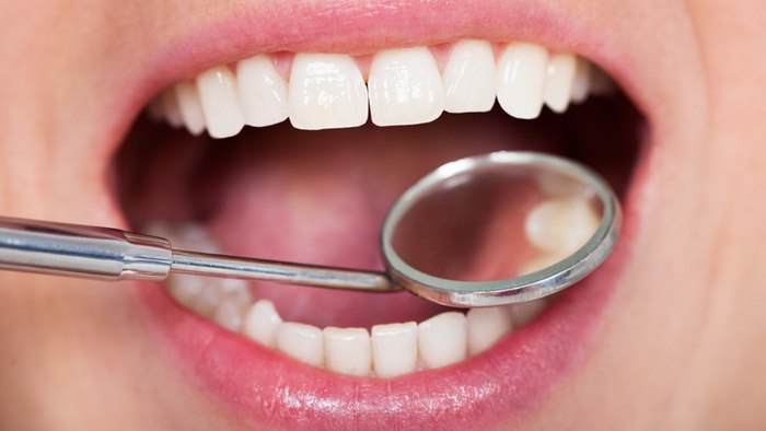 newnontoxicmaterialfordentalfillings